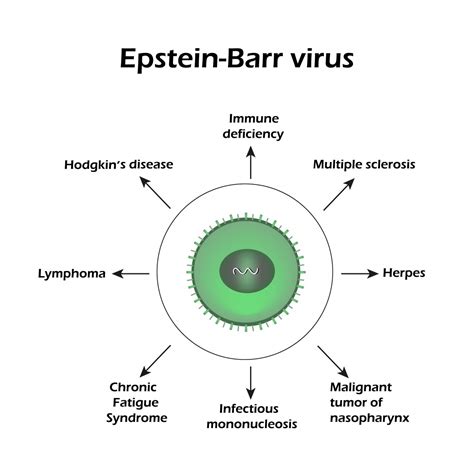epstein barr virus icd 10